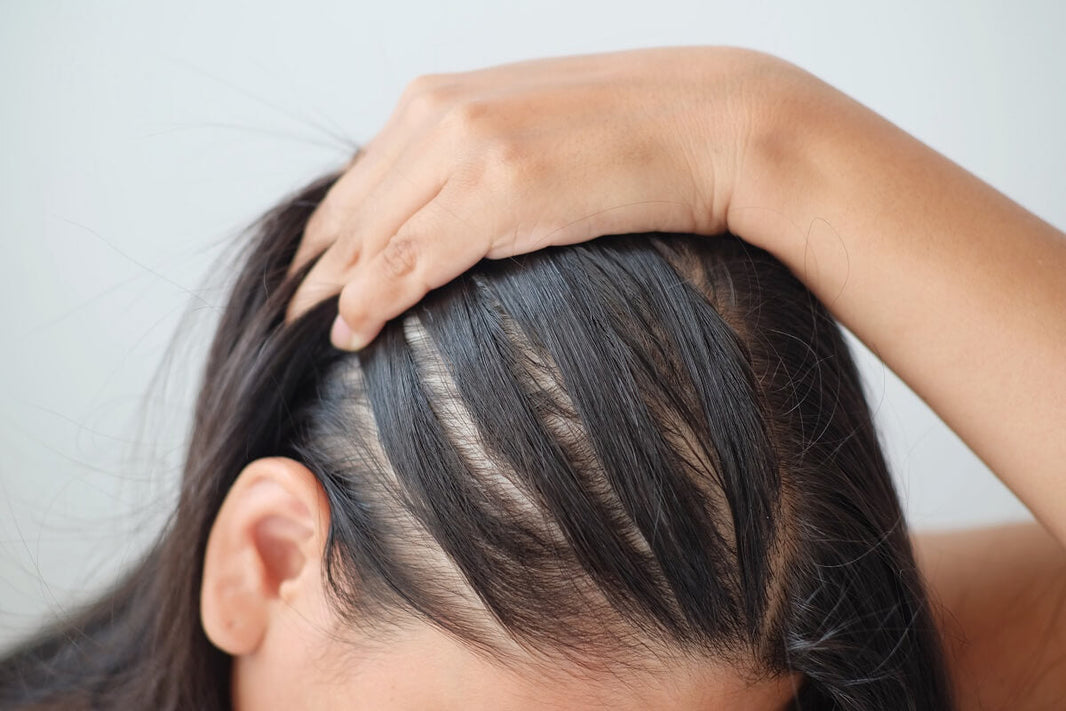 Hair Solutions for Women: How to Fix Thinning Hair